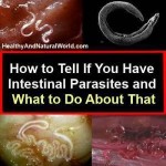 How to Tell If You Have Intestinal Parasites and What to Do About That