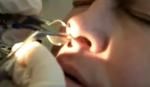 This Guy Thought There Was Something Wrong With His Nose. What The Doctor Pulls Out? OMG!