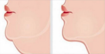These Simple Exercises Will Get Rid Of Your Double Chin Quickly!