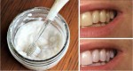 WATCH YOUR TEETH GET WHITE IN JUST 2 MINUTES WITH THIS HOME REMEDY
