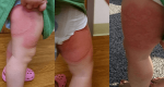 She Had No Idea Why Her Toddler’s Legs Look So Red. Then She Found The Cereal Box In The Pantry…