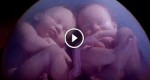 TWIN BABIES CAUGHT ON MRI SCAN FIGHTING IN THEIR MOTHER’S WOMB! AMAZING! VIDEO