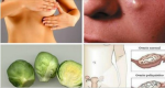 Remedies For Cysts In The Breast And Ovaries