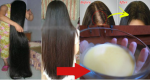 Hair Thickening Treatment for Bald Spots and Hair Fall | DIY GROW HAIR SUPER FAST