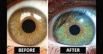 How Raw Food Diet Entirely Changed This Woman’s Eye Color!