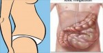 If Your Stomach Ever Gets Bloated, THIS Is How To Get Rid Of It