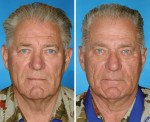 THIS IS WHAT 7 SMOKER VS. NON-SMOKER IDENTICAL TWINS LOOK LIKE AFTER YEARS OF LIGHTING UP