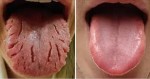 BE AWARE OF THIS: THESE 9 CHANGES ON THE TONGUE REVEAL ALMOST ALL YOUR DISEASES