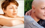 10 Cancer Symptoms Women Often Ignore, Must Read