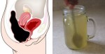 Detox and Relieve Constipation With This Apple Cider Vinegar and Honey Drink!