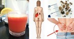 How To Make The Most Powerful Juice That Naturally Removes Kidney Stones And Gallstones!