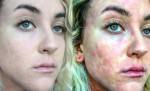 American Actress Ciena Nelson Reveals Gruelling Tale Of Her Skin Disease