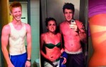 7 Serious Sunburns That Will Make You Fear The Summer!