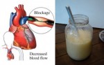 Don’t Let Heart Blockages Become Life Threatening. Use THIS Mix To Clean Your Arteries