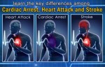 A Heart Attack, Cardiac Arrest, and Stroke Are Not The Same. Here Are The Key Differences