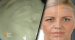 New NATURAL BOTOX: Make Your Own Home-Made Cream that’s Stronger than Botox! All you need is…