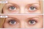 Lash Lift Could Be Dangerous For You. Know Here Why?
