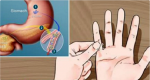 ARE YOU DIABETIC? FIND OUT IN JUST 1 MINUTE WITH THE FIVE FINGER TEST- AMAZING