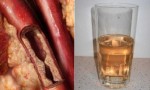 This Drink Will Unclog Arteries And Protects Against Heart Diseases. INGREDIENTS:2 tsp. ginger, grated,1 Cup…