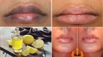 Awesome Remedy That Makes Your Lips Soft And Pink In Just 10 Minutes