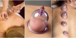 9 REASONS YOU SHOULD TRY CUPPING THERAPY