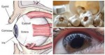 How To Use Pressed Garlic To Reverse Eyesight Loss Without Glasses Or Surgery