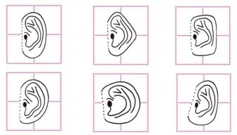 What Your Ear Shape Says About Your Personality