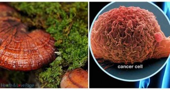 Nine Cancer Cures That Your Doctor Will Not Tell You About