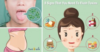 You Need To Flush Toxins From Your Body If You See These Warning Signs