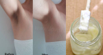 Lighten Dark Under Arms And Other Dark Body Area With Only One Ingredient Overnight
