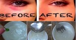 Do It Yourself The Most Effective Cream Anti Dark Circles Under the Eyes!