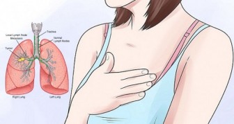 WHY HEARTBURN, ACID REFLUX AND STOMACH PAIN COULD BE EARLY WARNING SIGNS OF CANCER