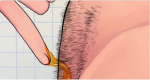 IMPRESSIVE! How To Naturally Remove Body Hair Permanently ( No Waxing Or Shaving )