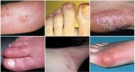 TAKE A GOOD LOOK AT YOUR FEET: THESE 10 Signs May Indicate a Serious Health Problem