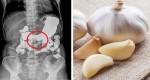 See What Happens Why you Eat Garlic On an Empty Stomach For 7 Days