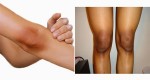 15 Effective Tips To Get Rid Of Black Knees And Elbow