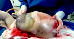 Nurse Films The Rare Moment A Baby Is Born Inside A Fully Intact Amniotic Sac