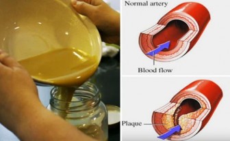 SAY GOODBYE TO CLOGGED ARTERIES, HIGH BLOOD PRESSURE AND BAD CHOLESTEROL!