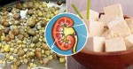 MAN HAS 420 KIDNEY STONES REMOVED IN ONE OPERATION… AND DOCTOR SAYS HIS LOVE OF TOFU IS THE REASON TO BLAME