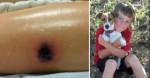 Boy Dies 2 Weeks After THIS Dark Mark Shows Up On His Leg