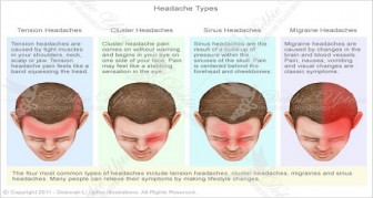 Five Types Of Headaches And How To Get Rid Of Them!
