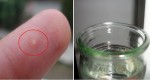 SIMPLE AND PAINLESS TRICK TO REMOVE STRUBBORN SPLINTERS IN YOUR SKIN USING ONLY A BOTTLE
