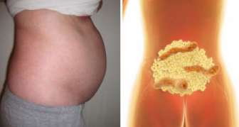 THIS IS WHY YOU HAVE BLOATED STOMACH AND HOW TO GET RID OF BLOATING AND LOSE WEIGHT OVERNIGHT!