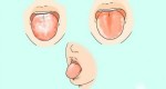 WARNING SIGNS ON YOUR TONGUE THAT CAN MEAN YOUR COLON, LIVER OR HEART IS TOXIC