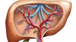 DO YOU HAVE HIGH LIVER ENZYMES OR A FATTY LIVER?