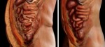 JUST USE THESE 2 INGREDIENTS TO EMPTY ALL DEPOSITS OF FAT AND PARASITES OF YOUR BODY WITHOUT EFFORT