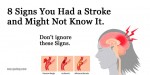 8 Signs You Had a Stroke and Might Not Know It. Don’t Ignore These Signs!