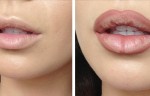 6 Natural Ways To Get Lips Like Kylie Jenner, #5 Works Everytime