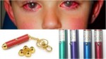 Burn Injury to the Eyes: One Little Boy Lost His Sight Because of This Toy That You Probably Have at Home