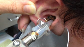 This guy experiences a sharp pain in ears! So INSANE!